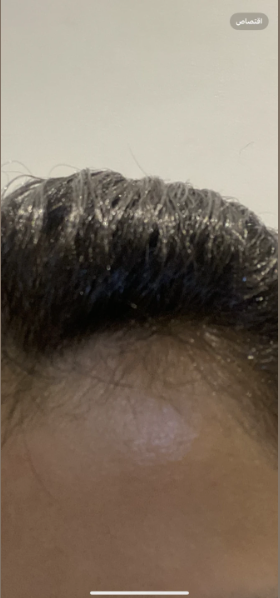 مرغمة عثمان