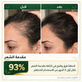 ثلاث زجاجات