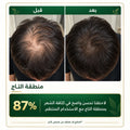 زجاجتان — الأكثر مبيعاً