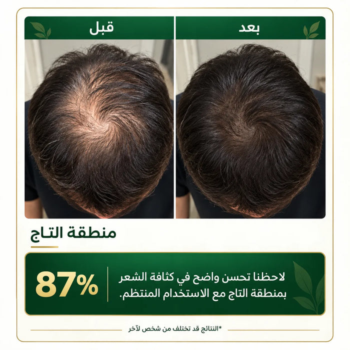 قبل وبعد ٦٠ يوم