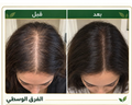 زجاجة واحدة